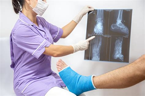 Bone Fracture Types Causes Treatment Total Orthocare