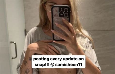 Charlie Sheens Daughter Sami Admits Shes In Agony After Going Under Knife For Boob Job ‘back