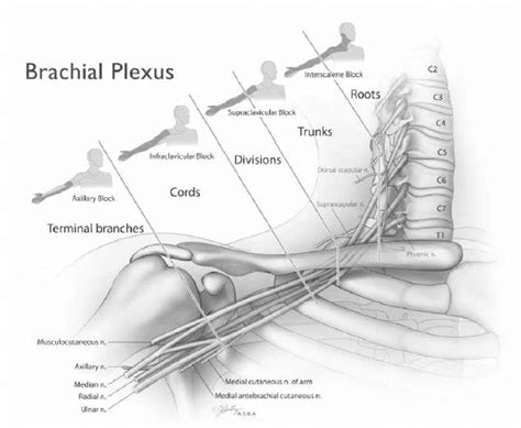 Brachial Plexus Block Anesthesia