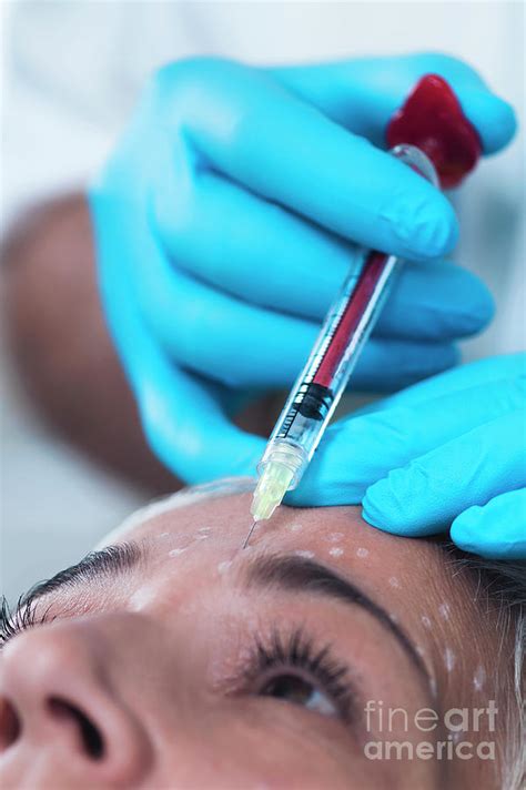 Woman Having Hyaluronic Acid Injections Photograph By Microgen Images Science Photo Library