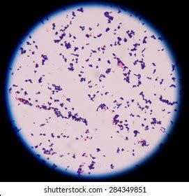 Pneumoniae, along with species of lower virulence such as staph. Gram Positive Images, Stock Photos & Vectors | Shutterstock