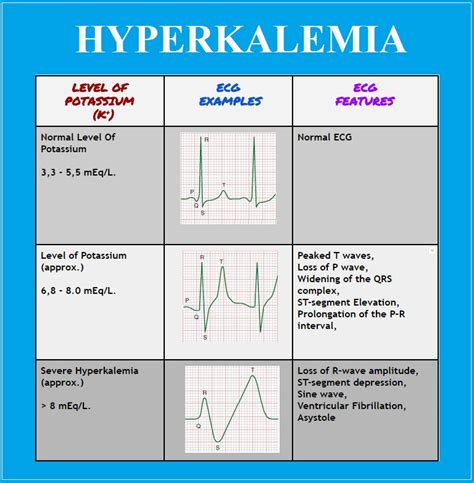 Ecg Changes With Hypo Hyperkalemia Anesthesia Board R