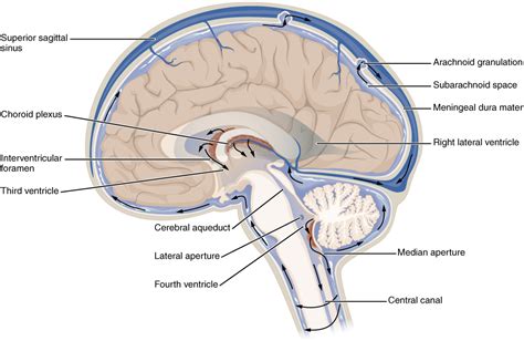 Ventricular System Illustration Radiology Case