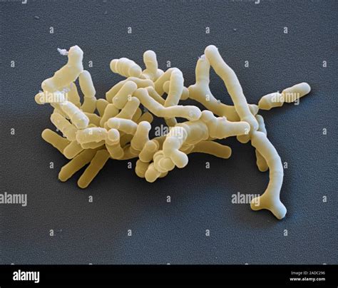 Bifidobacteria Coloured Scanning Electron Micrograph Sem