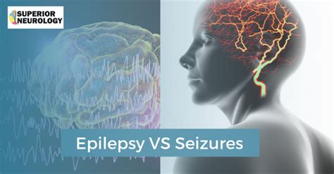 What Is The Difference Between Epilepsy And Seizures