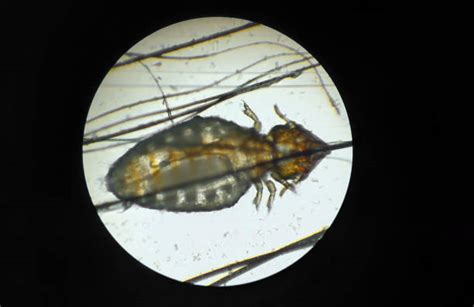 Microscopic Photo Of Head Lice Stock Photos Pictures And Royalty Free