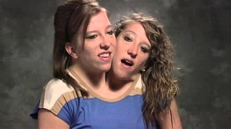 Conjoined Twins Abby And Brittany Hensel Live A Low Profile Life Today After Their Reality Tv Days