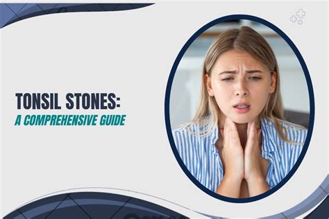 Tonsil Stones Causes Symptoms And Treatment A Comprehensive Guide