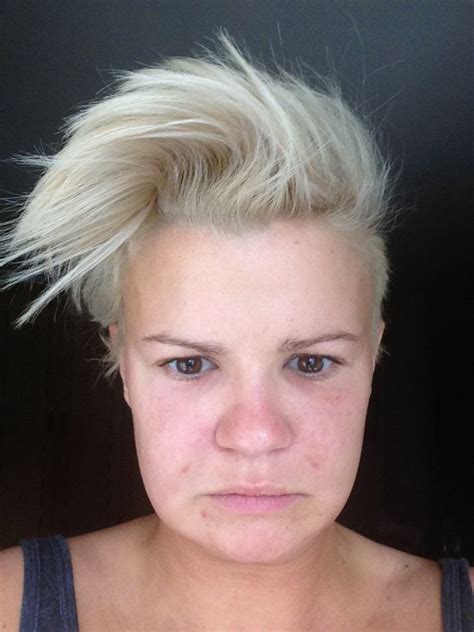 Kerry Katona Reveals How She Feared For Her Life When Her Face Swelled After Vampire Facelift