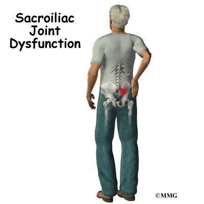 Sacroiliac Joint Dysfunction Eorthopod Com