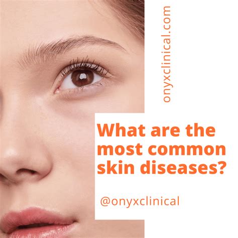 What Are The Most Common Skin Diseases Onyx Clinical