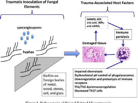 Necrotizing Pancreatitis Treatment Antibiotics