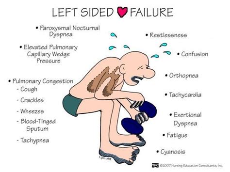 Left Sided Heart Failure Biology Forums Gallery Nursing Mnemonics