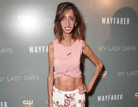 Here Is Another Reminder That Worlds Ugliest Woman Lizzie Velasquez Is SUCH An Incredible