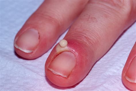 15 Health Warnings Your Fingernails May Be Sending