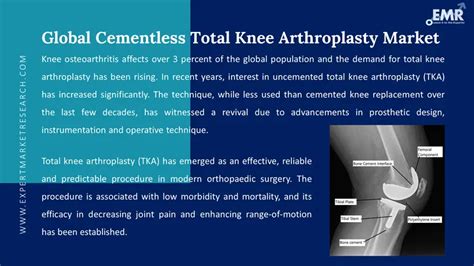 Cementless Total Knee Arthroplasty Market Growth 2024 2032