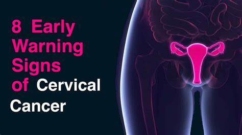 8 Early Warning Signs Of Cervical Cancer