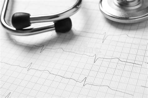 Stethoscope On Cardiogram Report Closeup Heart Diagnosis Stock Image