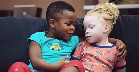 Mom Teaches Black And White Twins To Embrace Their Differences