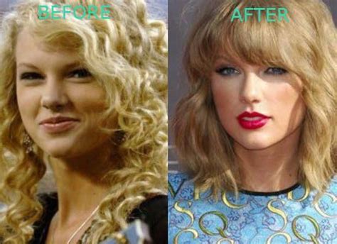 Taylor Swift Nose Job And Possible Blepharoplasty Plastic Surgery
