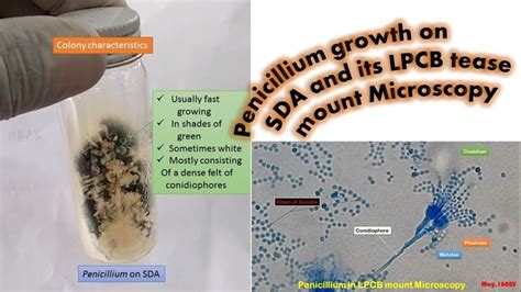 Penicillium Growth On Sda And Its Lpcb Tease Mount Microscopy