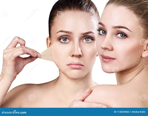Woman Removes Her Old Dry Skin From Face Stock Photo Image Of Layer