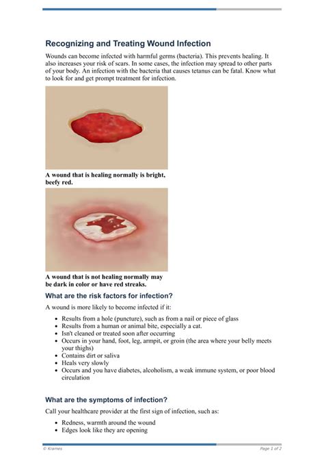 Pdf Recognizing And Treating Wound Infection Healthclips Online