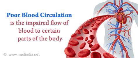 Poor Blood Circulation Causes Symptoms Diagnosis And Treatment