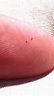 Seed ticks. : pics