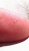 Seed ticks. : pics