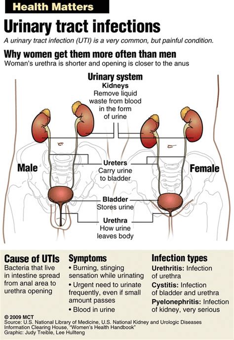 UTI Facts Urinary Tract Infection