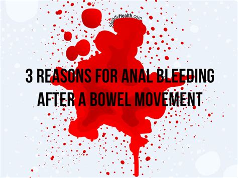 3 reasons for anal bleeding after a bowel movement gastrointestinal disorders articles body