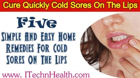5 Easy Home Remedies For Cold Sores On The Lips