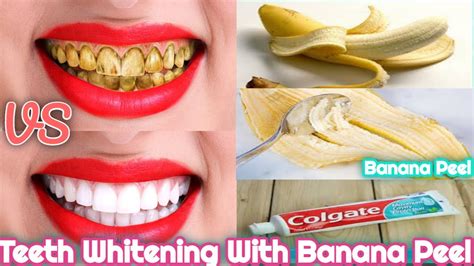 How To Whiten Your Teeth With A Banana Peel Youtube