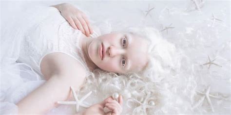 Series Of Albinism Pictures Shows Ethereal Beauty Of People With Albinism