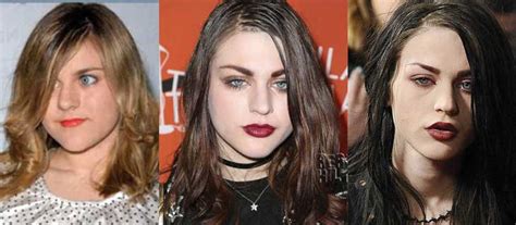 Get the latest news on frances bean cobain, including song releases, album announcements, tour dates, festival appearances, and more. Frances Bean Cobain Plastic Surgery Before and After ...