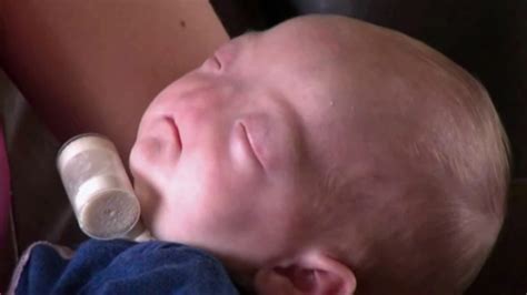 Alabama Baby Born Without Nose Is Perfect Abc7 San Francisco