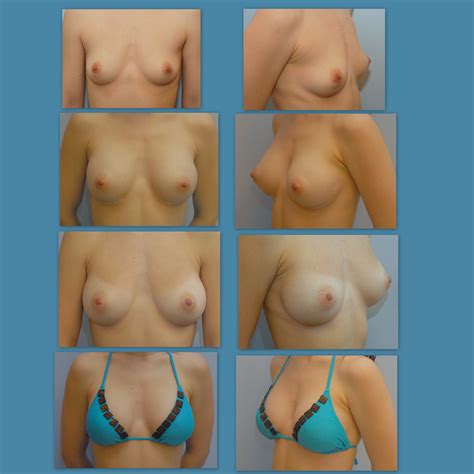Breast Size Boob Chart