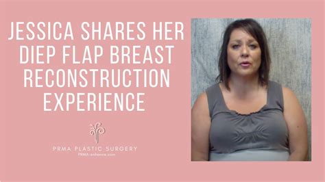 Choosing Diep Flap Breast Reconstruction Jessica Shares Her