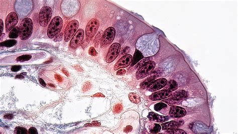 Epithelial Tissues Mucous Glands In Simple Columnar Epith Flickr