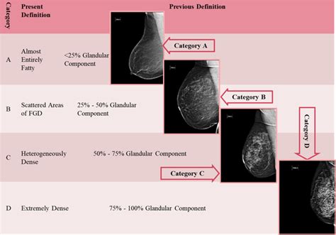 The Breast Imaging Reporting And Data System BI RADS Made Easy IJ