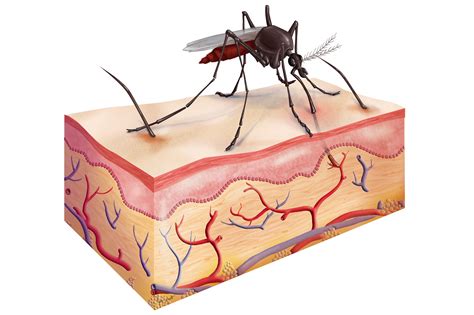 53 Mosquito Bite Diagram Michelaadomas