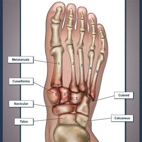 Charcot Foot Trialexhibits Inc