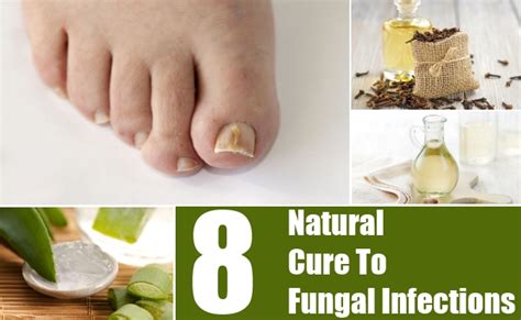 8 Natural Cures For Fungal Infections How To Cure Fungal Infections