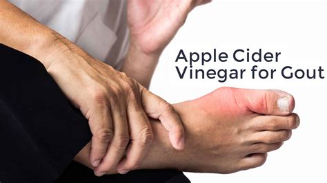 How To Use Apple Cider Vinegar For Gout