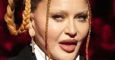 Grammy 2023 Madonna Surge Irreconhecível Hoje E Choca Cirurgia Plástica