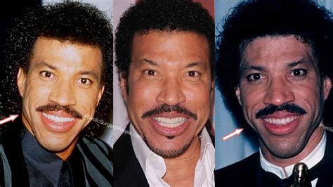 Lionel Richie Before And After: The Scary Secret Behind The Singer's