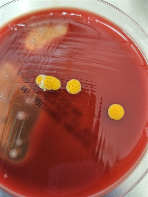 Noticeable Yellow Colony Appeared Rmicrobiology