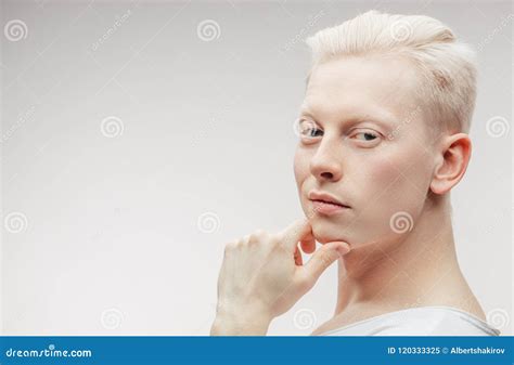 Ontdek De Fascinerende Wereld Van Albino Mannelijke Modellen Klik