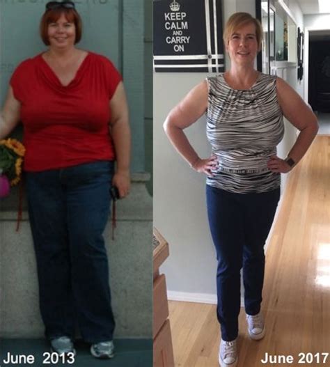Its Been 4 Years Since My Gastric Sleeve Surgery Read About My Weight